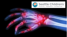 Team Seattle Children's - Rheumatology's avatar